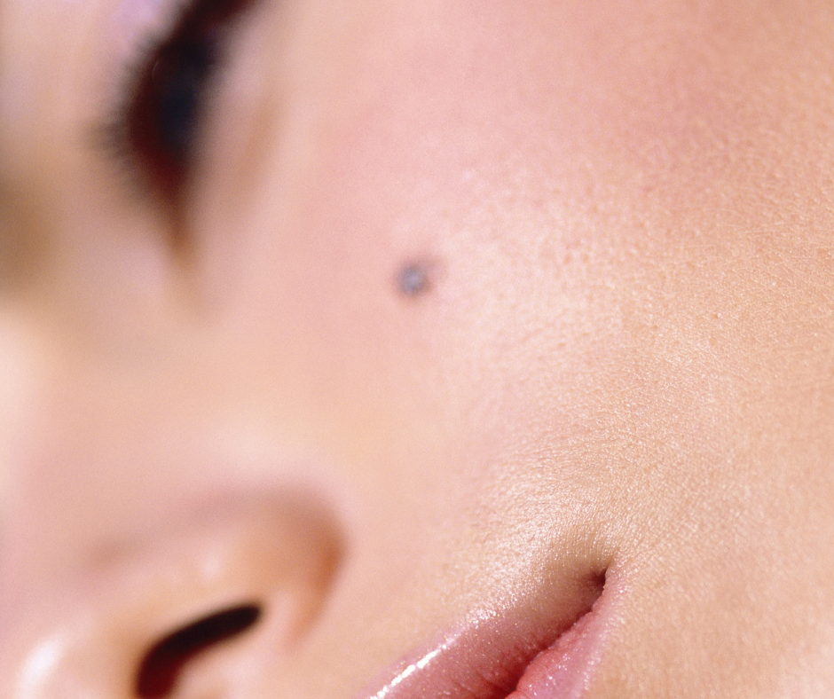 Permanent beauty mark by Jeannine Unwin