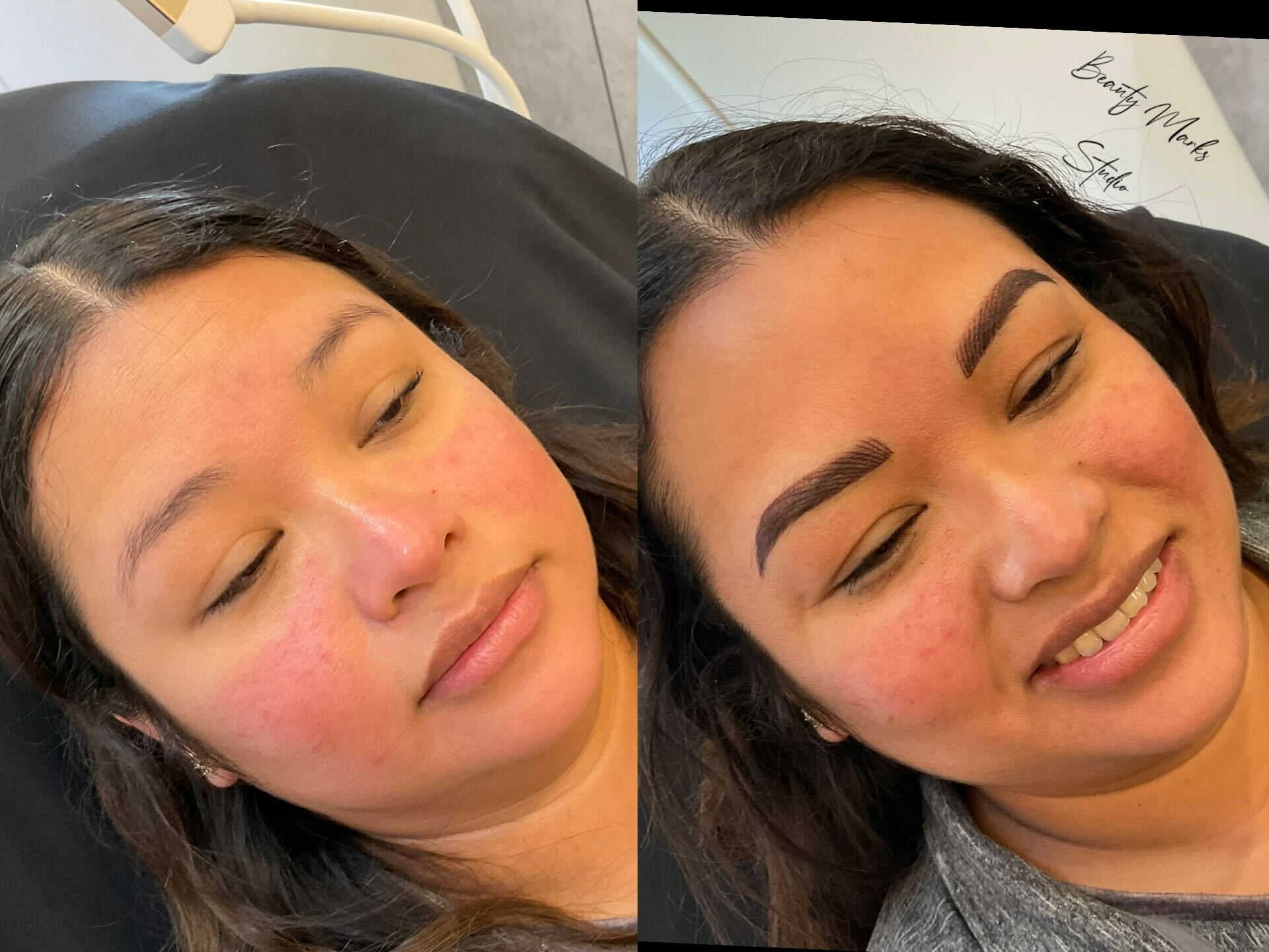 Before and after brows - complete result
