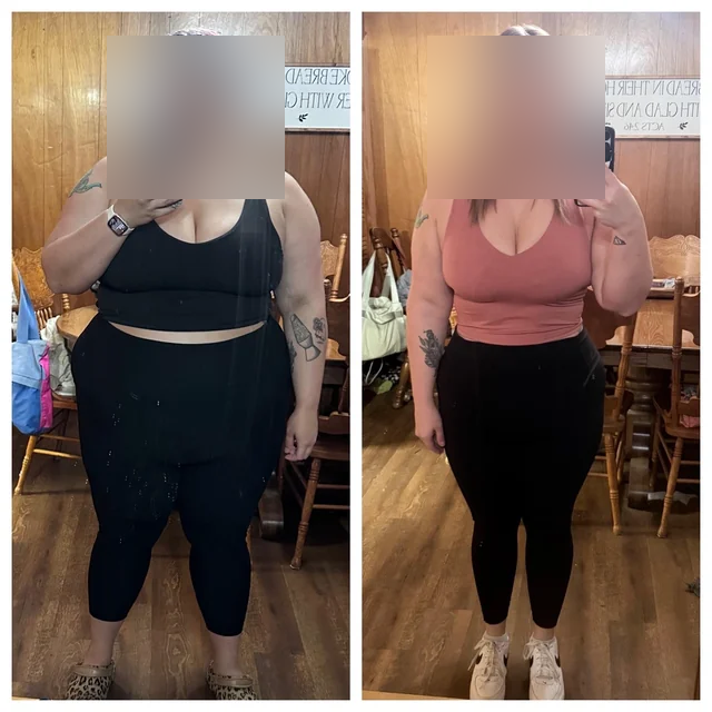 Megan before and after