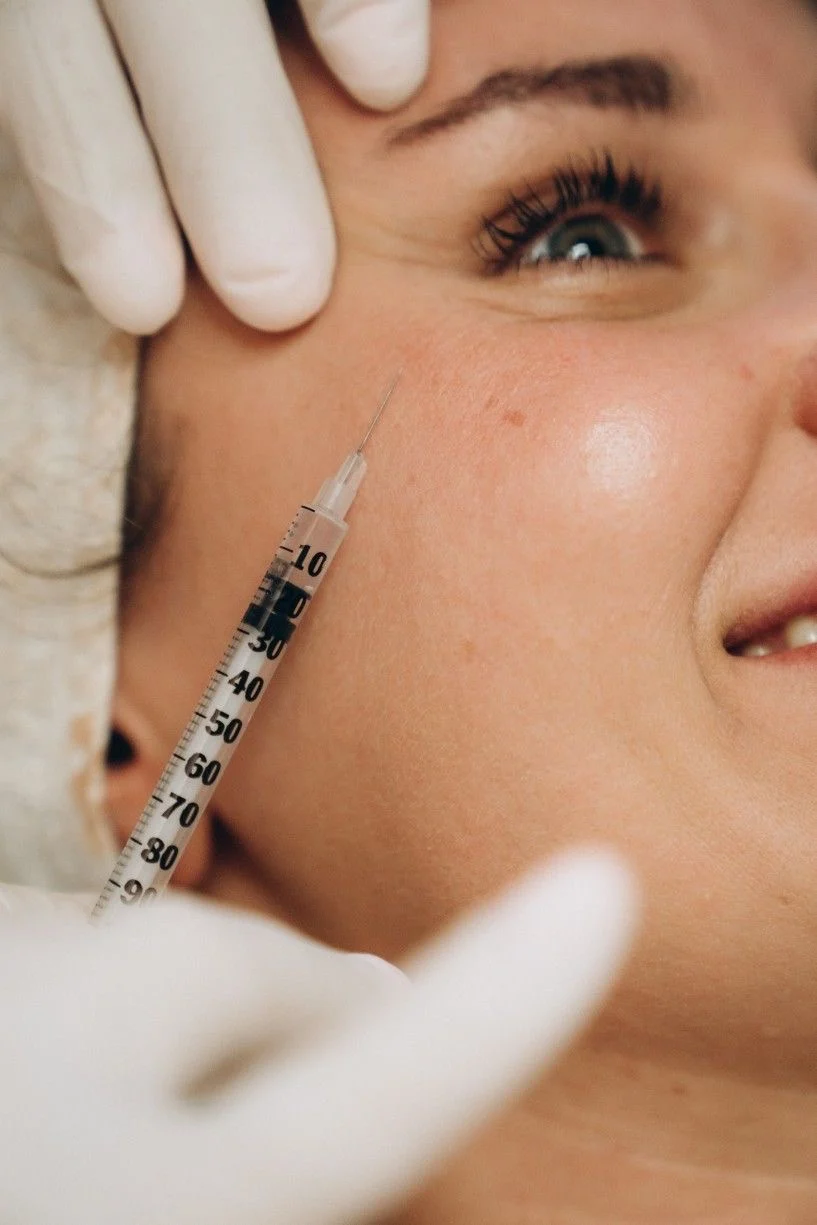 Tox Club Botox membership treatment in Doncaster