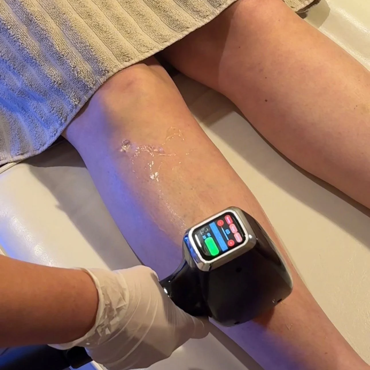 Laser treatment at The NEYA Clinic