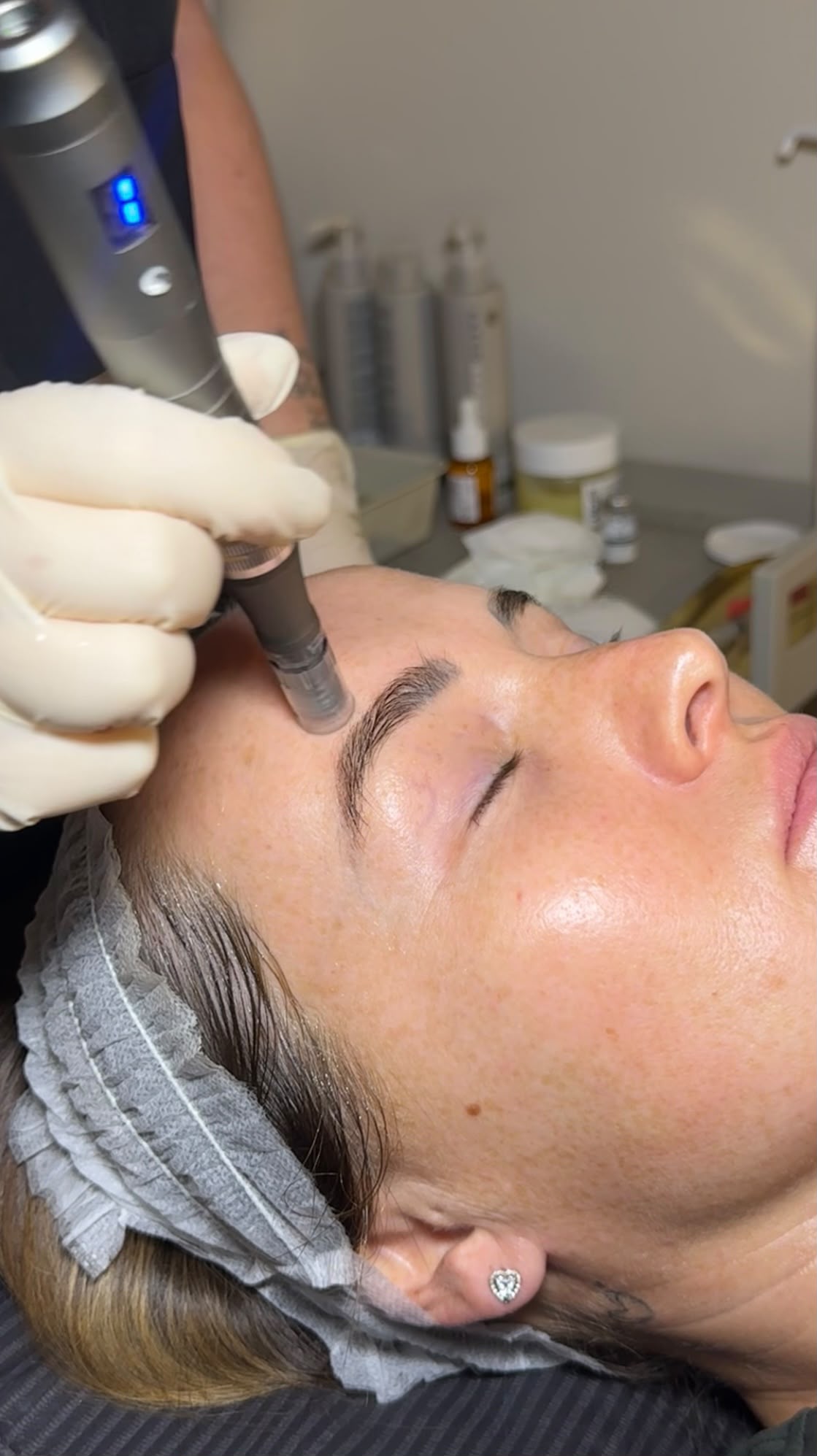 Skin treatment at The Neya Clinic