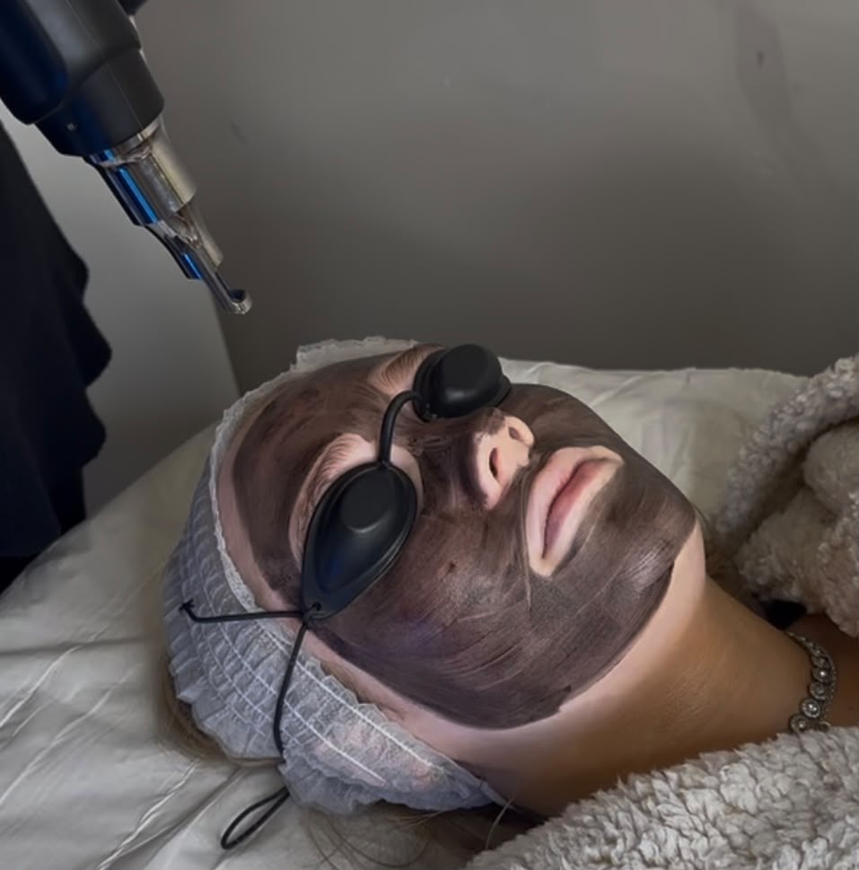 Laser facial treatment at The Neya Clinic