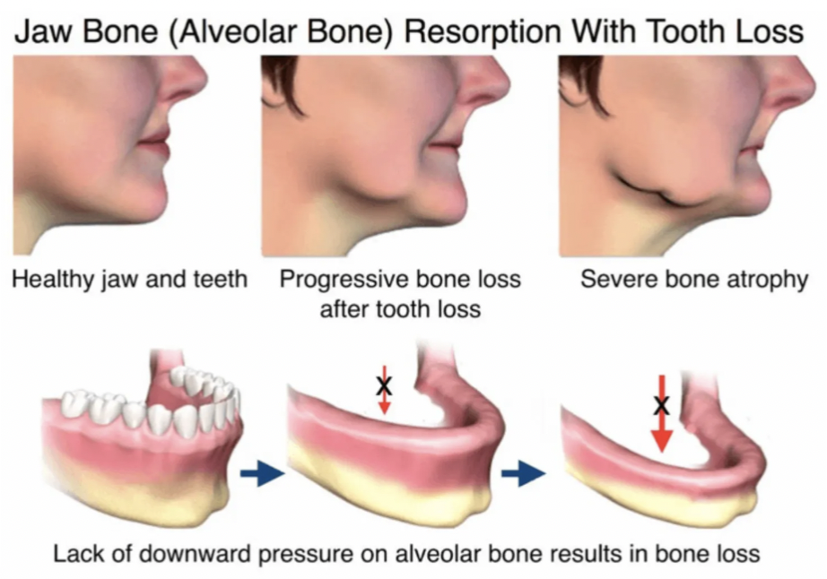 free-implant-consult-package-dr-christopher-chin