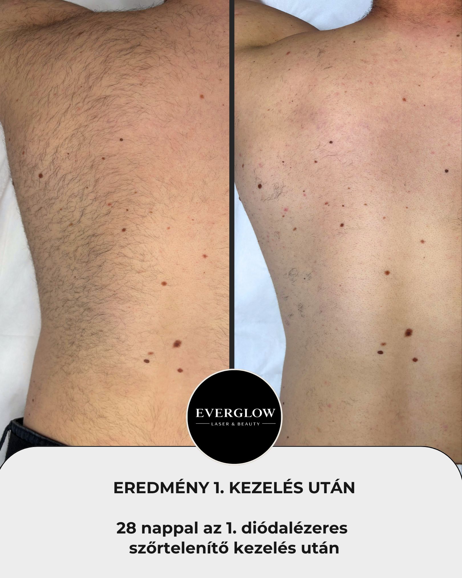 Eredmény az első kezelés után 3