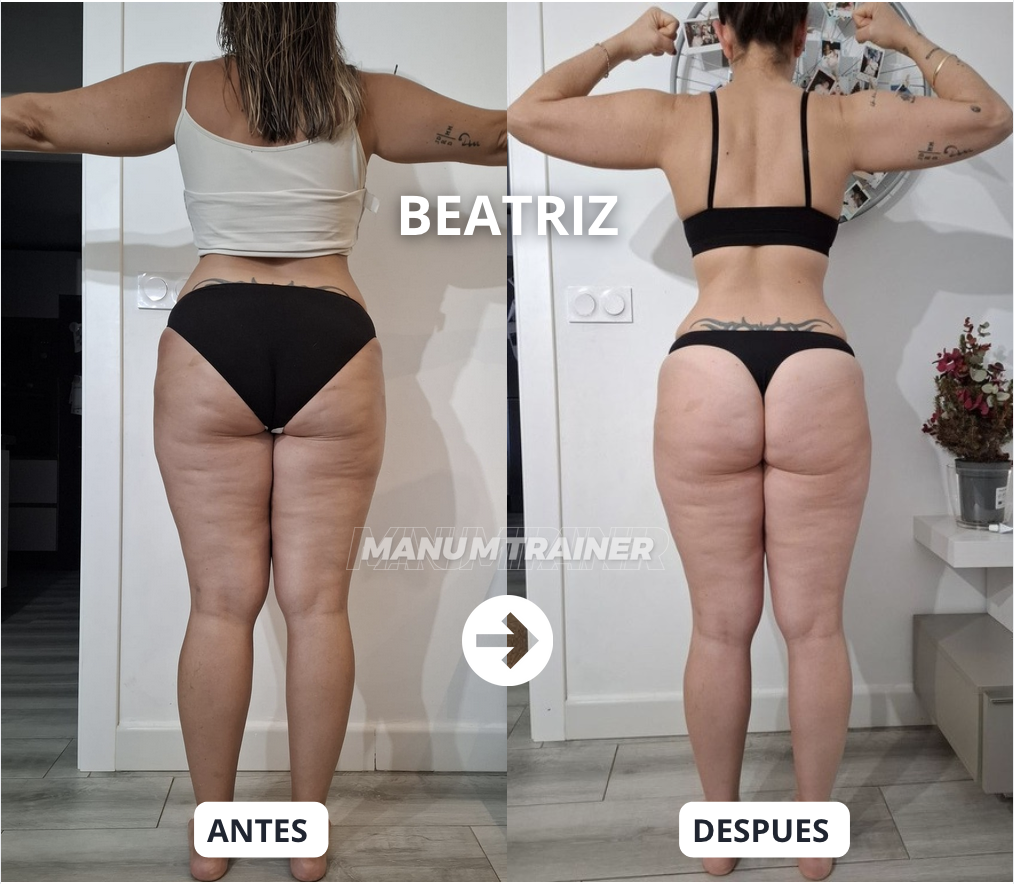 Antes y después Beatriz