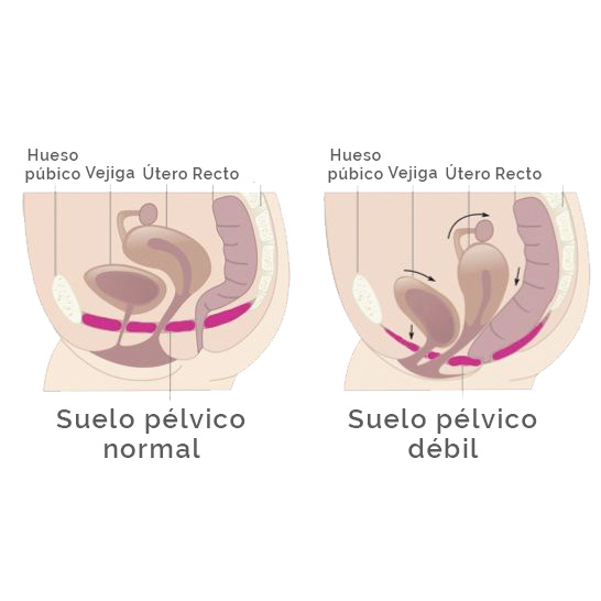 Relajación vaginal - esquema