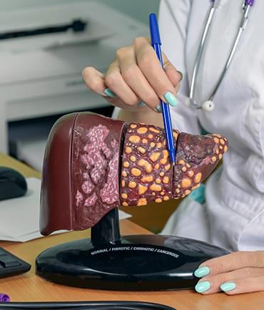 A healthy liver next to a cirrhotic liver damaged by alcohol
