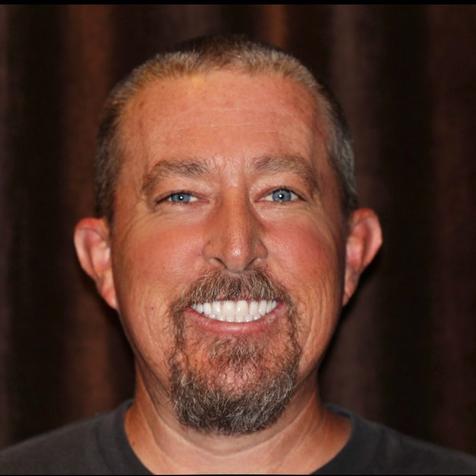 After full-arch implant case