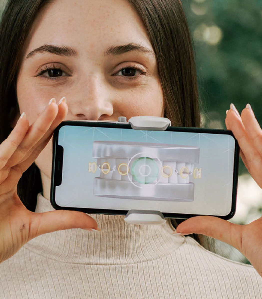 Clear Ceramic Braces