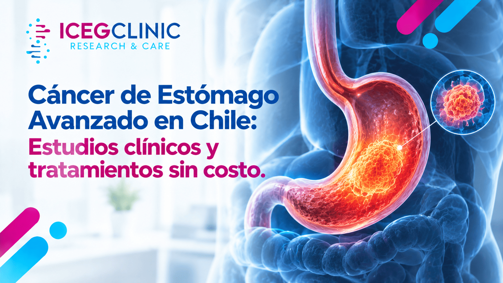 Cáncer de Estómago Avanzado en Chile: Estudios Clínicos y Tratamientos Sin Costo