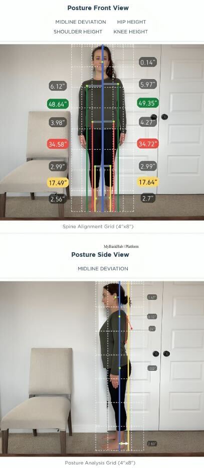 MyBackHub Posture Visuals report displaying side-by-side front and profile views of a user. The images are overlaid with an AI-generated spine alignment grid, showing specific measurements for midline deviation, shoulder height, hip symmetry, and knee height.