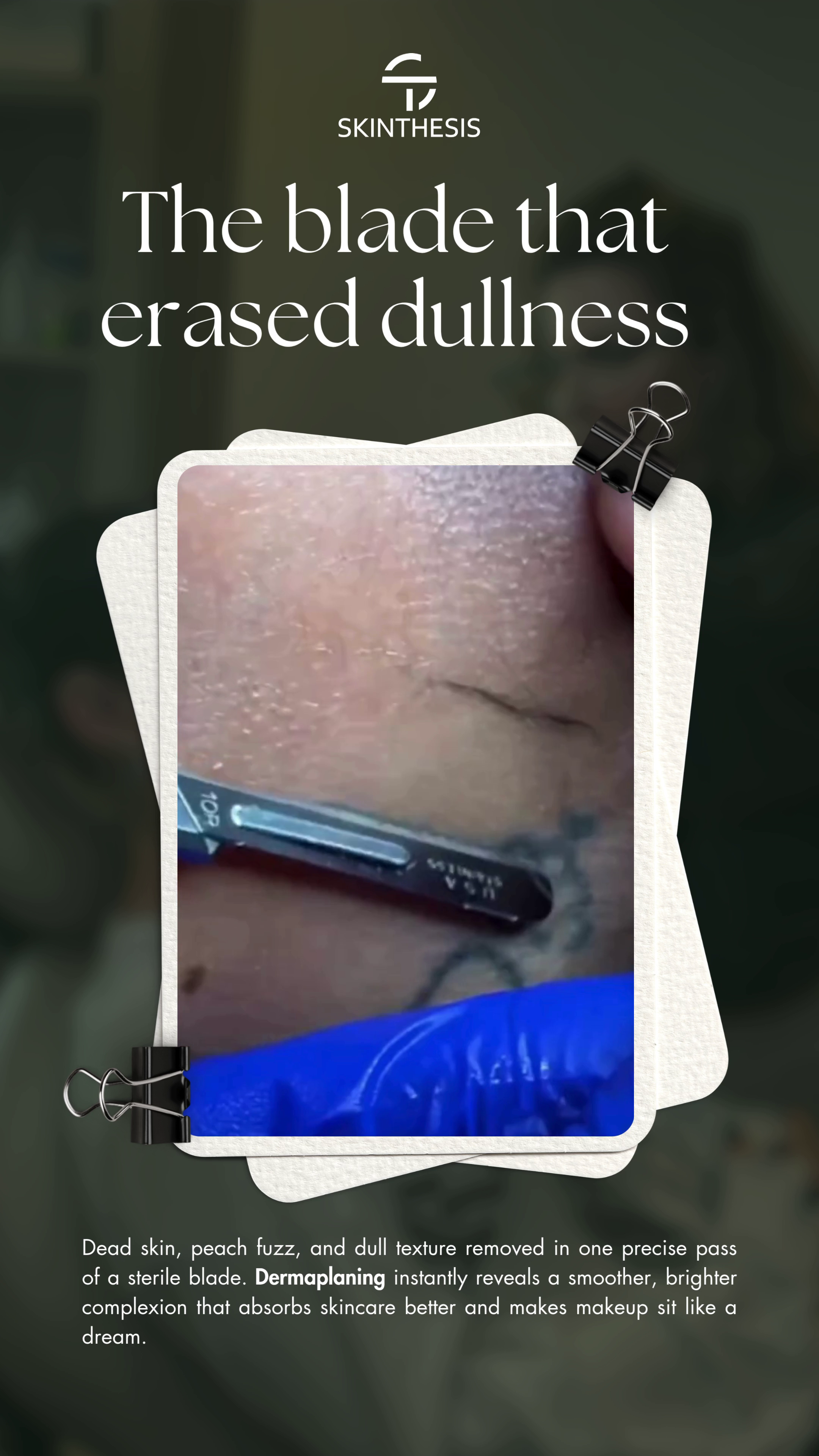 The blade that erased dullness video — Skinthesis