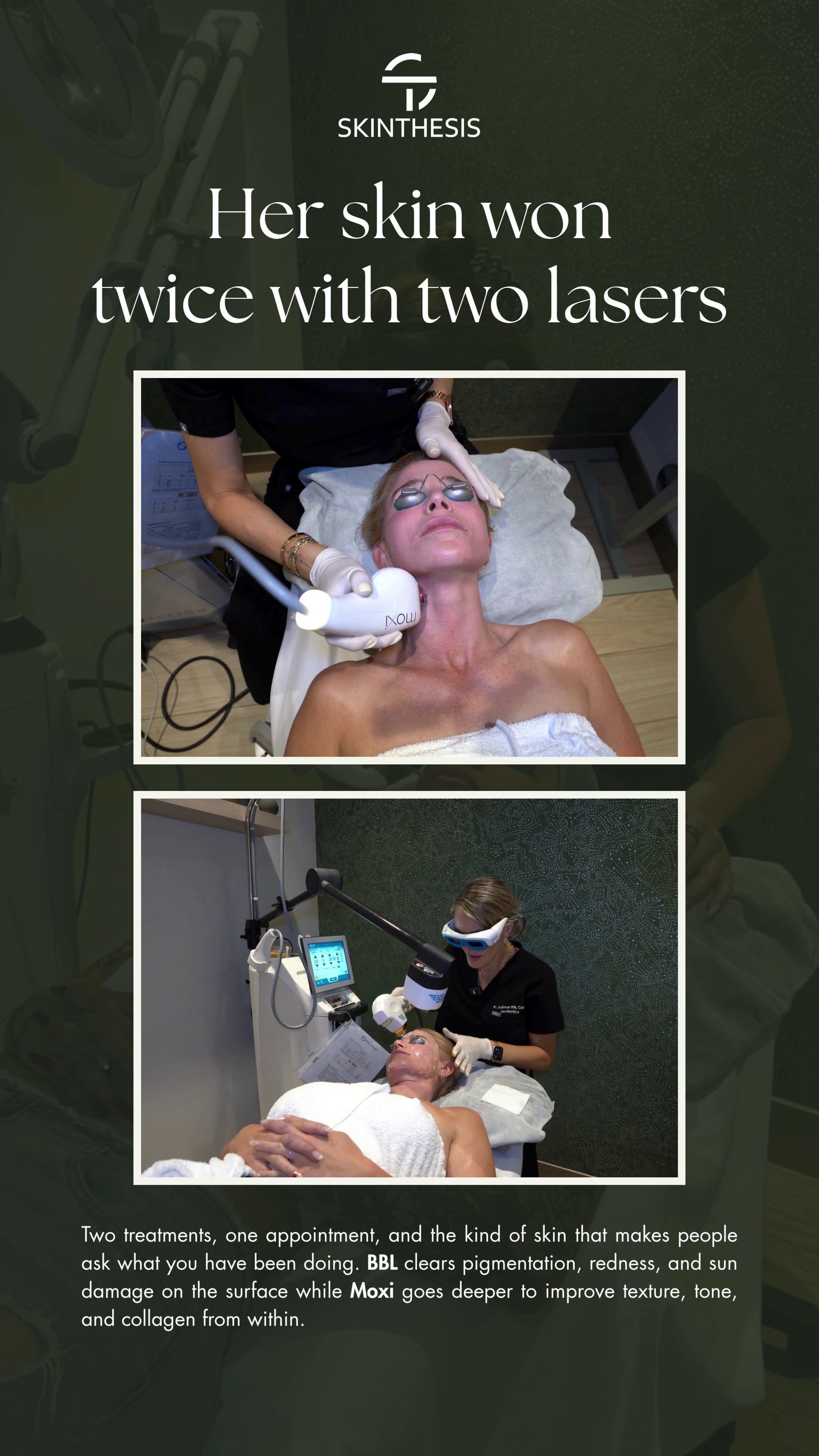 Her skin won twice with two lasers video — Skinthesis