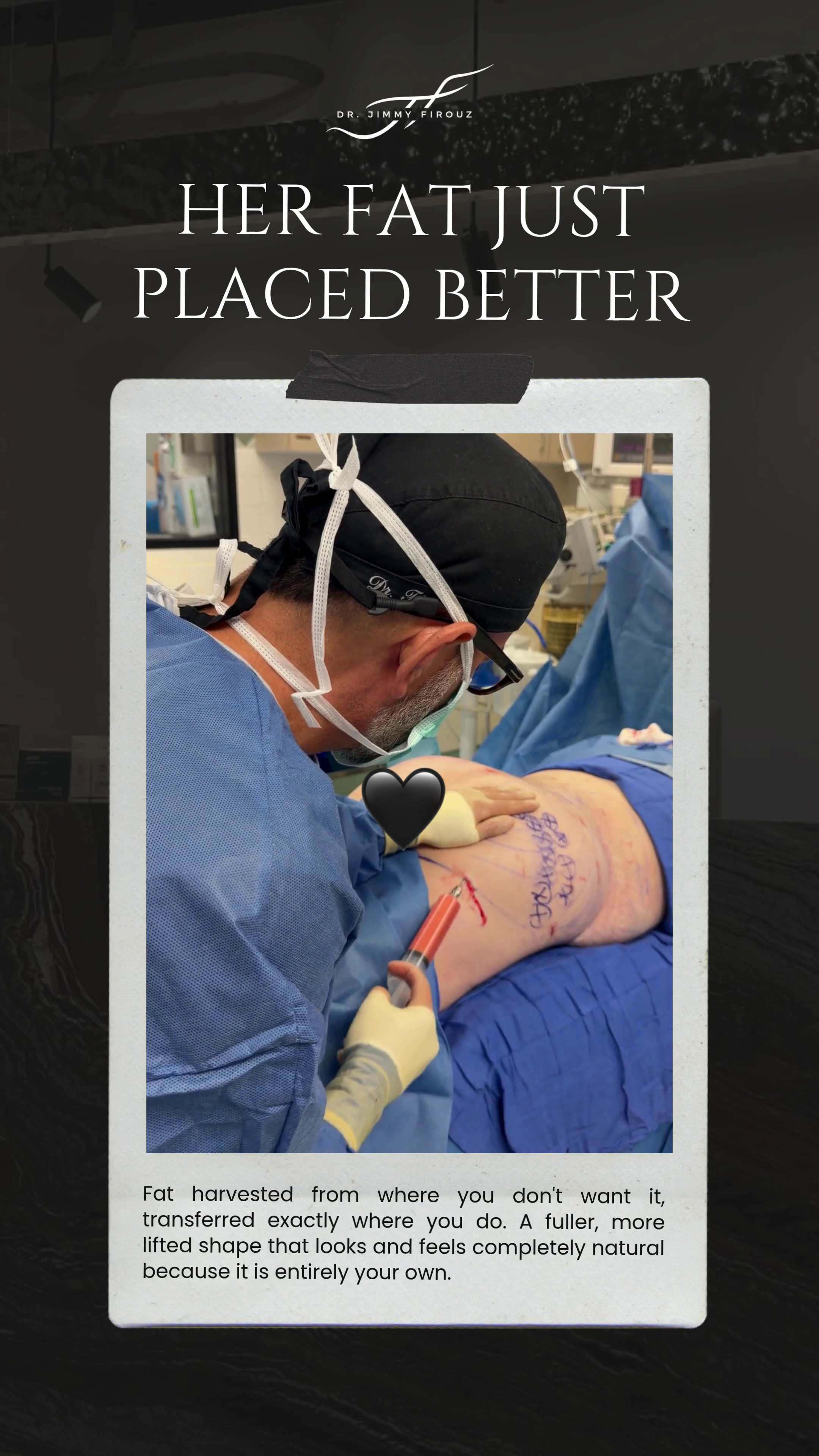 Her fat just placed better video — Dr. Jimmy Firouz
