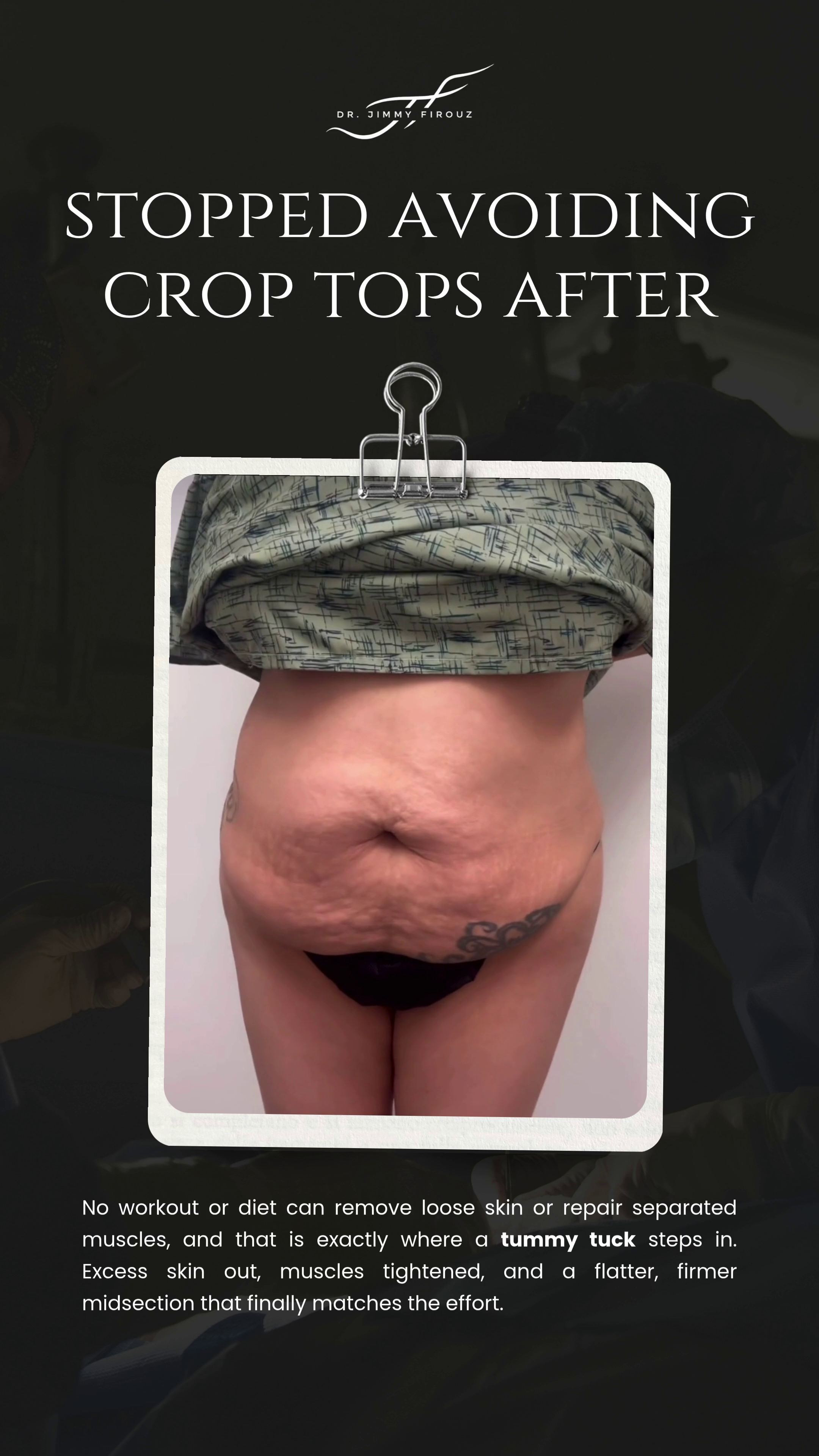 Stopped avoiding crop tops after video — Dr. Jimmy Firouz