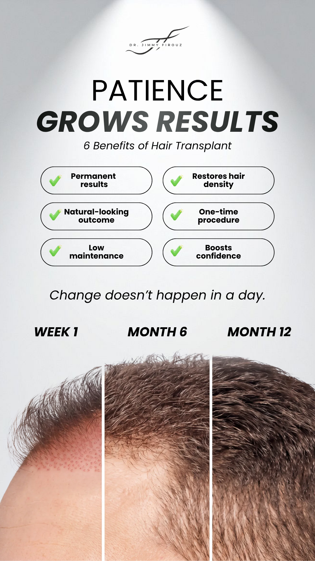 6 benefits of hair transplant — Dr. Jimmy Firouz