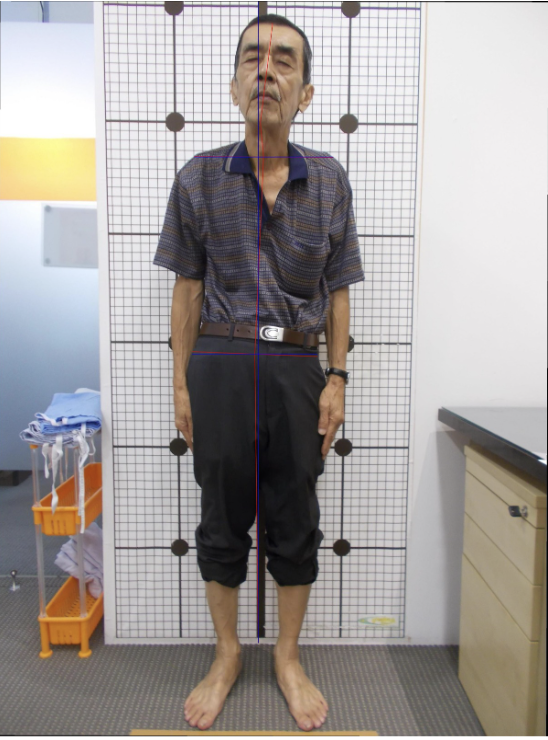 Posture scan before care: shoulders and hips tilted, body leaning off centre grid line