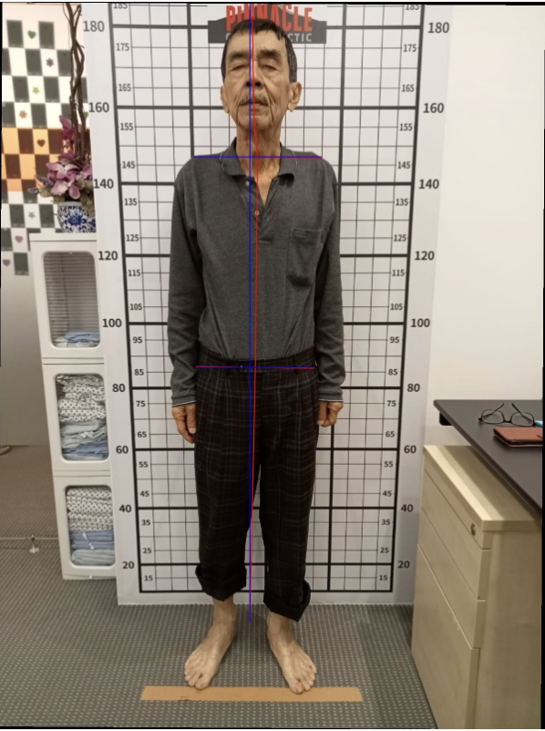 Posture scan after care: shoulders levelled and body aligned closer to centre grid line