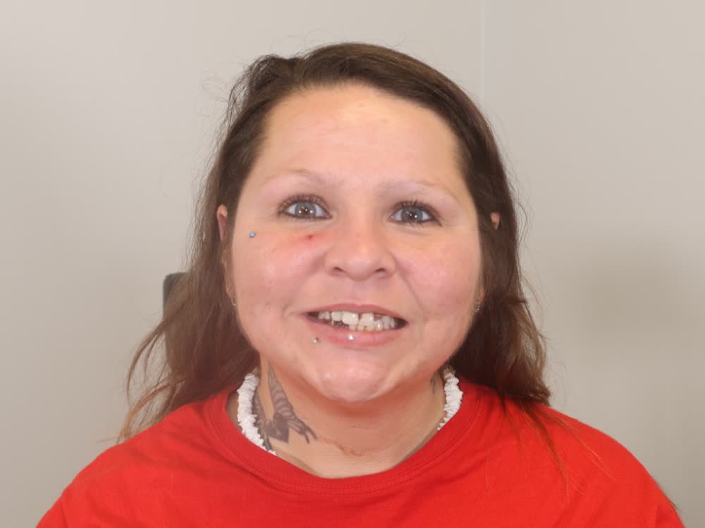 Cynthia before treatment