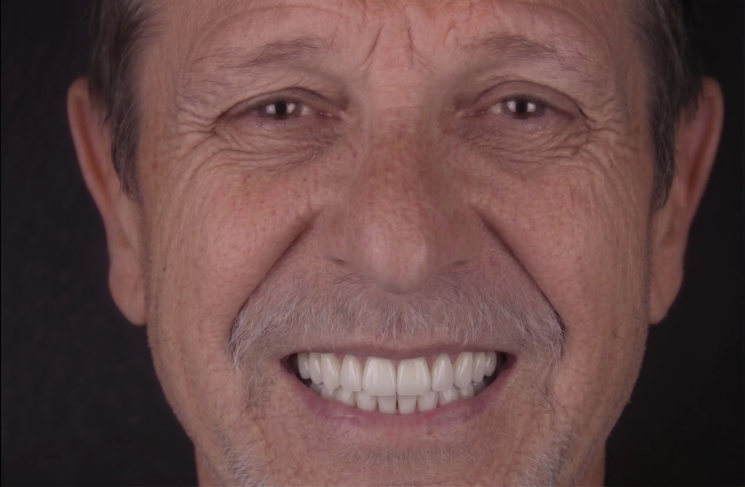 Patient with a confident new smile after dental implants