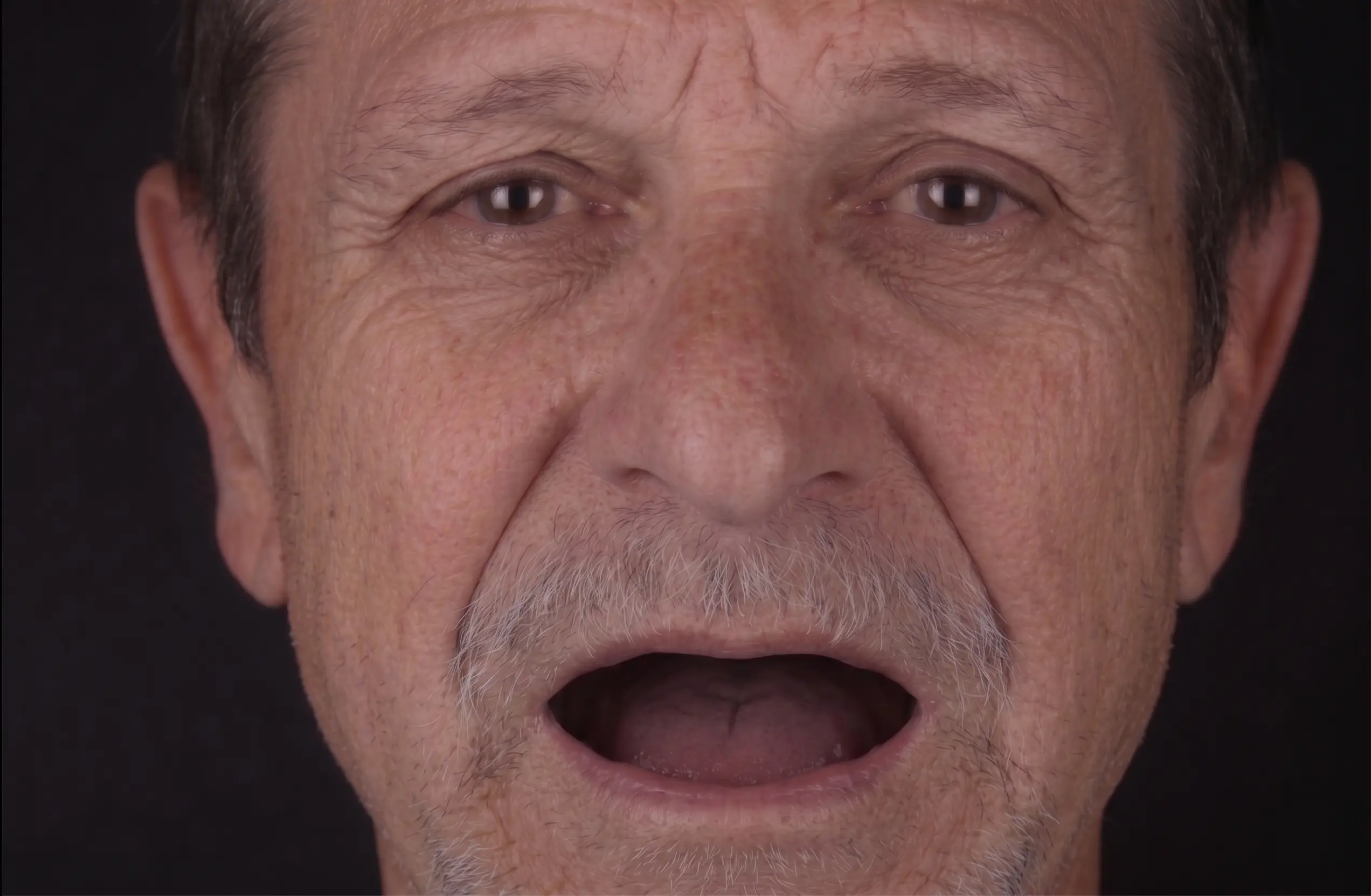 Patient still waiting without treatment