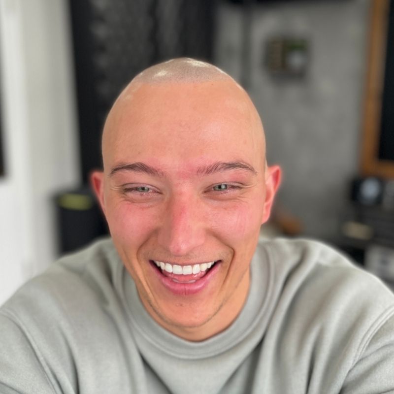 Happy Scalp Nation client