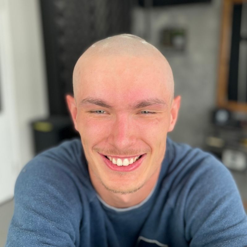 Happy Scalp Nation client