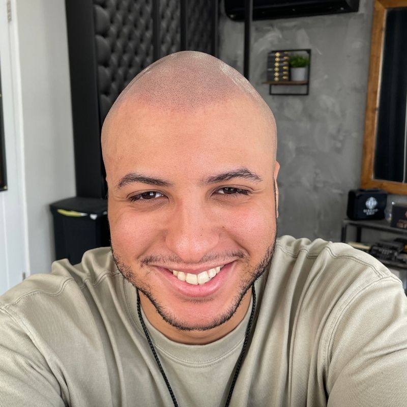 Happy Scalp Nation client