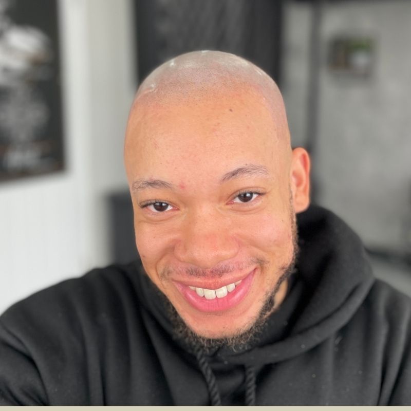 Happy Scalp Nation client