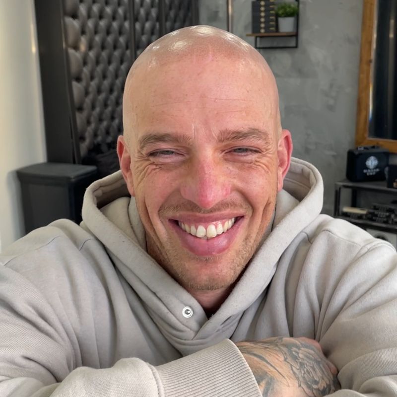 Happy Scalp Nation client
