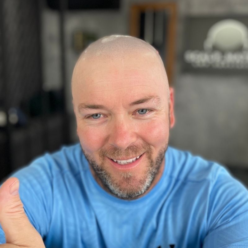 Happy Scalp Nation client