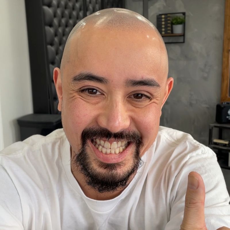 Happy Scalp Nation client