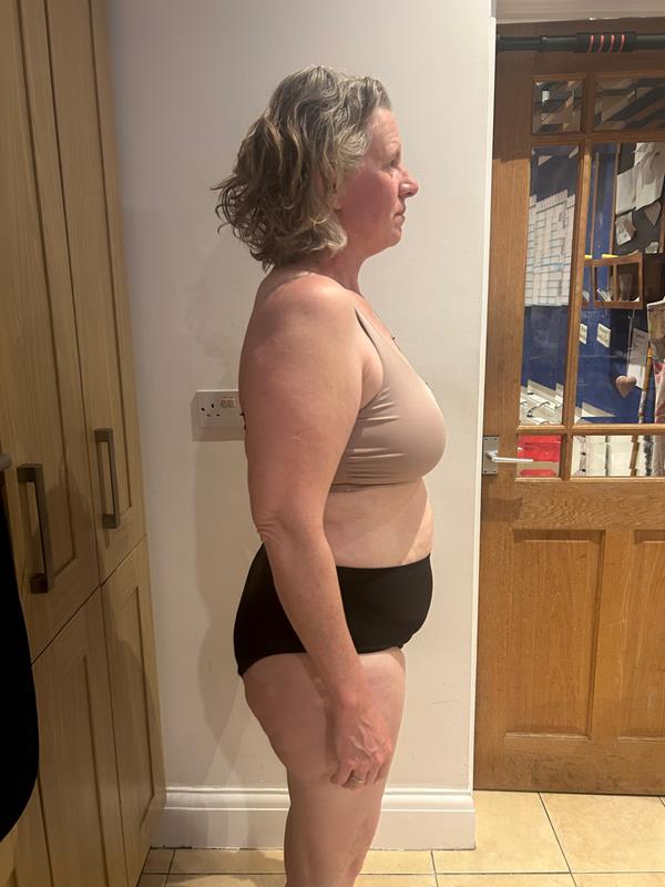 Michelle, before, side view