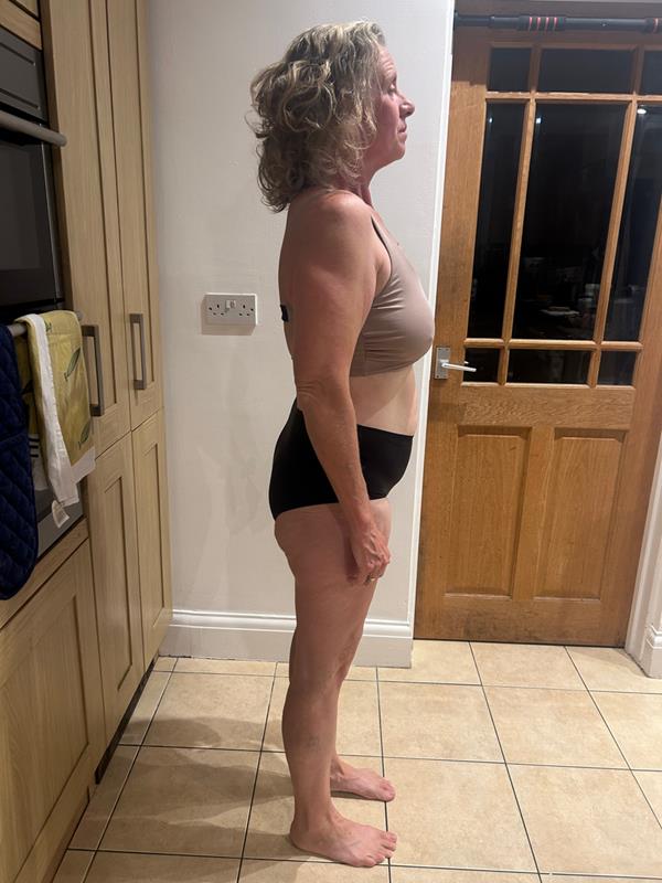 Michelle, after, side view