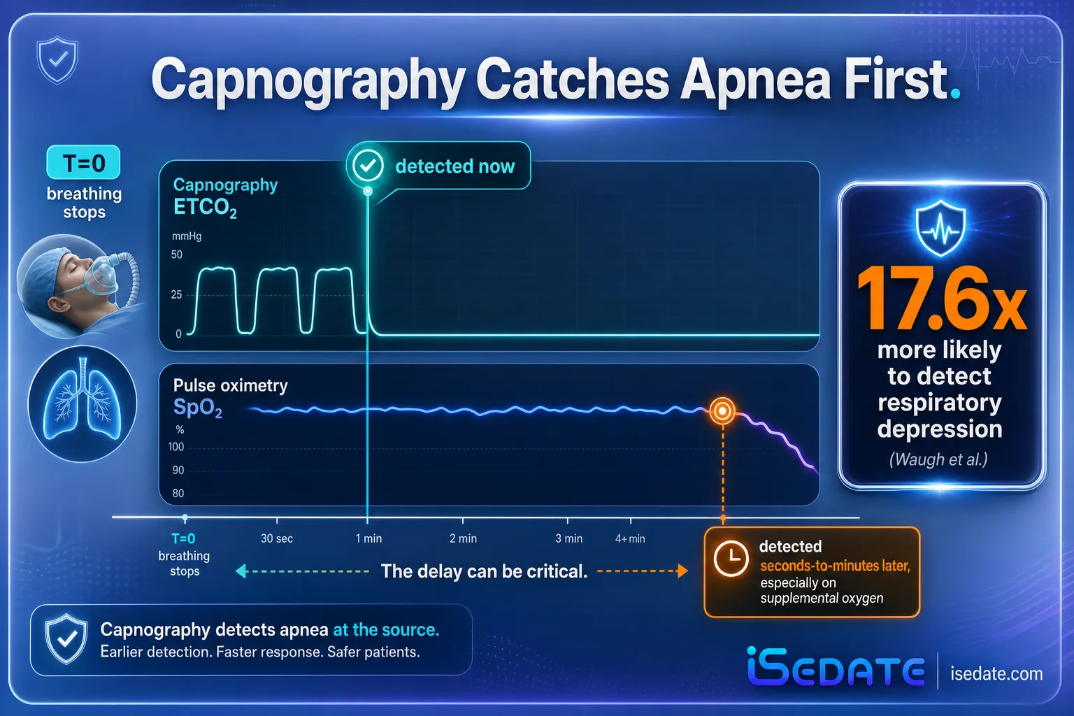 Timeline infographic showing capnography detecting apnea immediately while pulse oximetry lags Timeline infographic showing capnography detecting apnea immediately while pulse oximetry lags