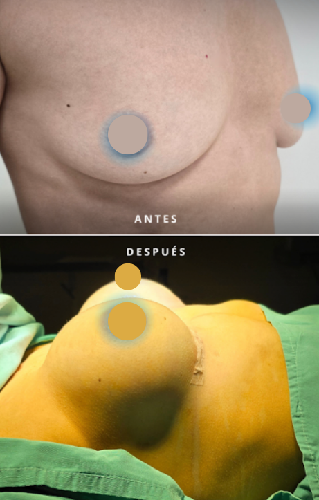 Comparación antes y después de la cirugía - paciente 8