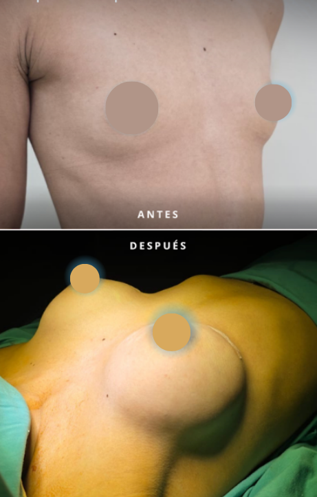 Comparación antes y después de la cirugía - paciente 7