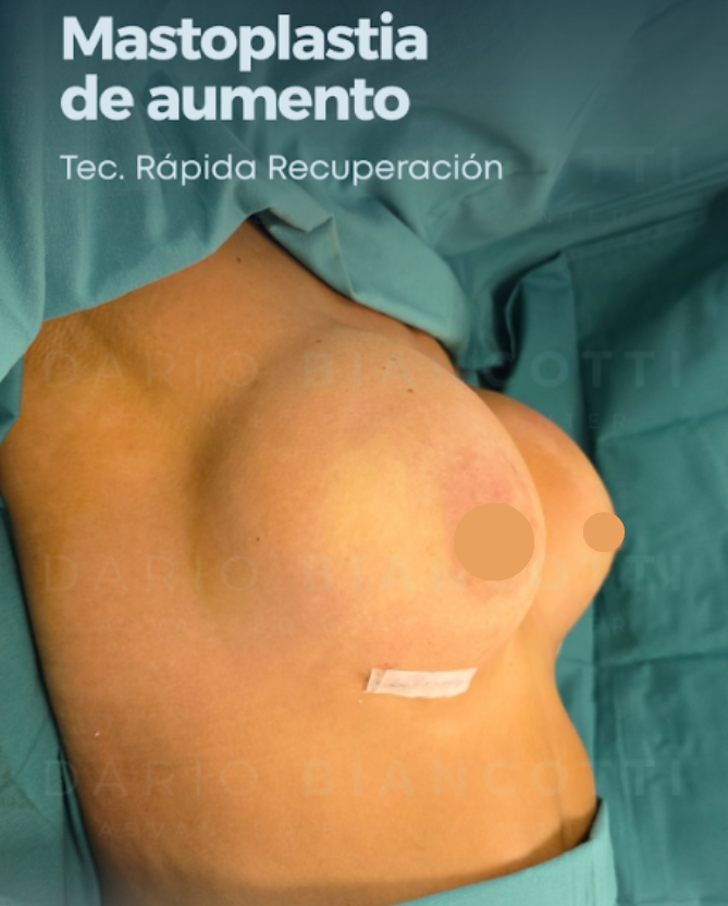 Resultado después de la cirugía - paciente 3