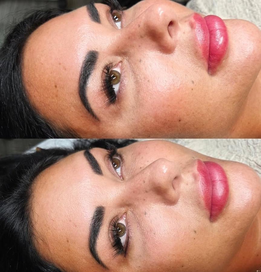 Cosmetic Tattoo healed result