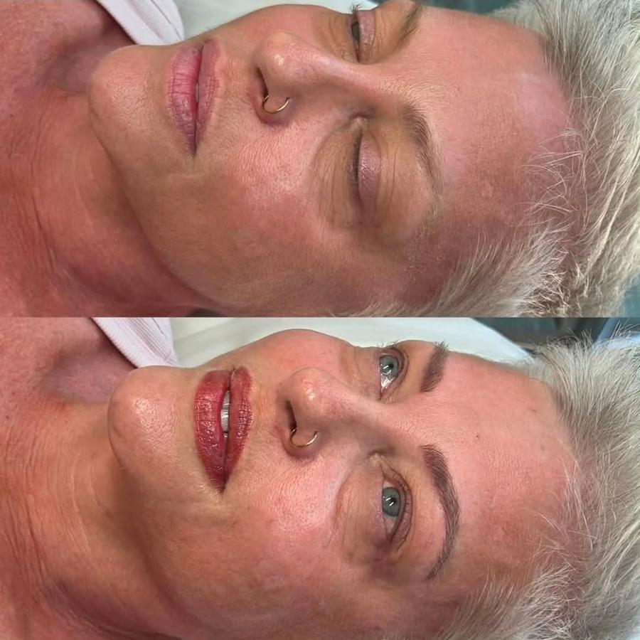 Cosmetic Tattoo healed result