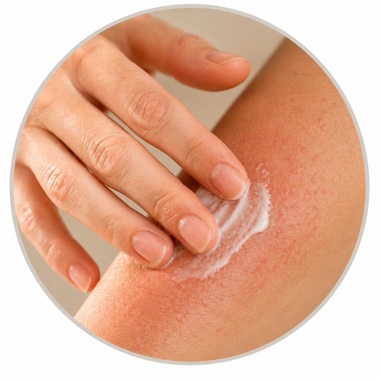 Close-up of skin condition being treated