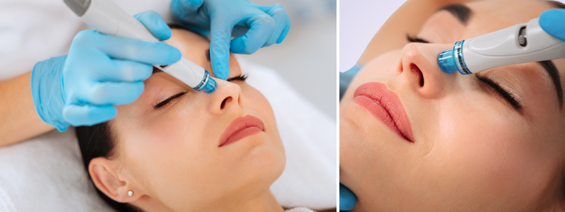 HydraFacial