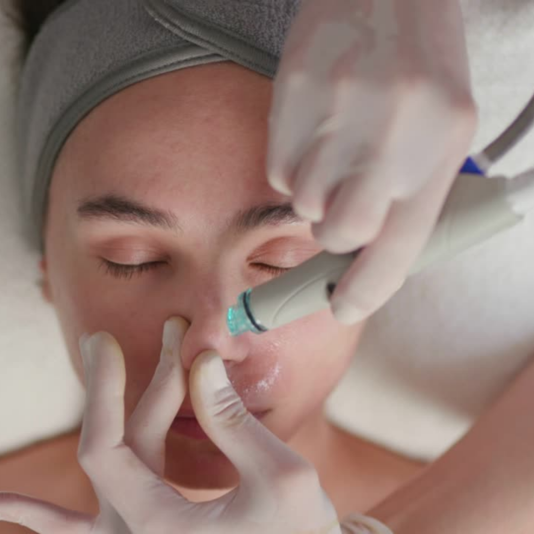 close up of a woman getting a hydrfacial