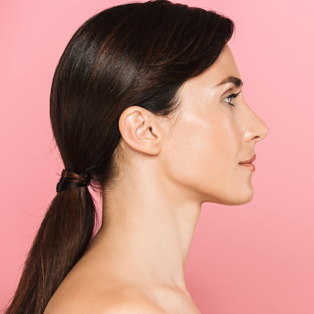 side profile of a young woman to show she does not have a double chin because of kybella treatment