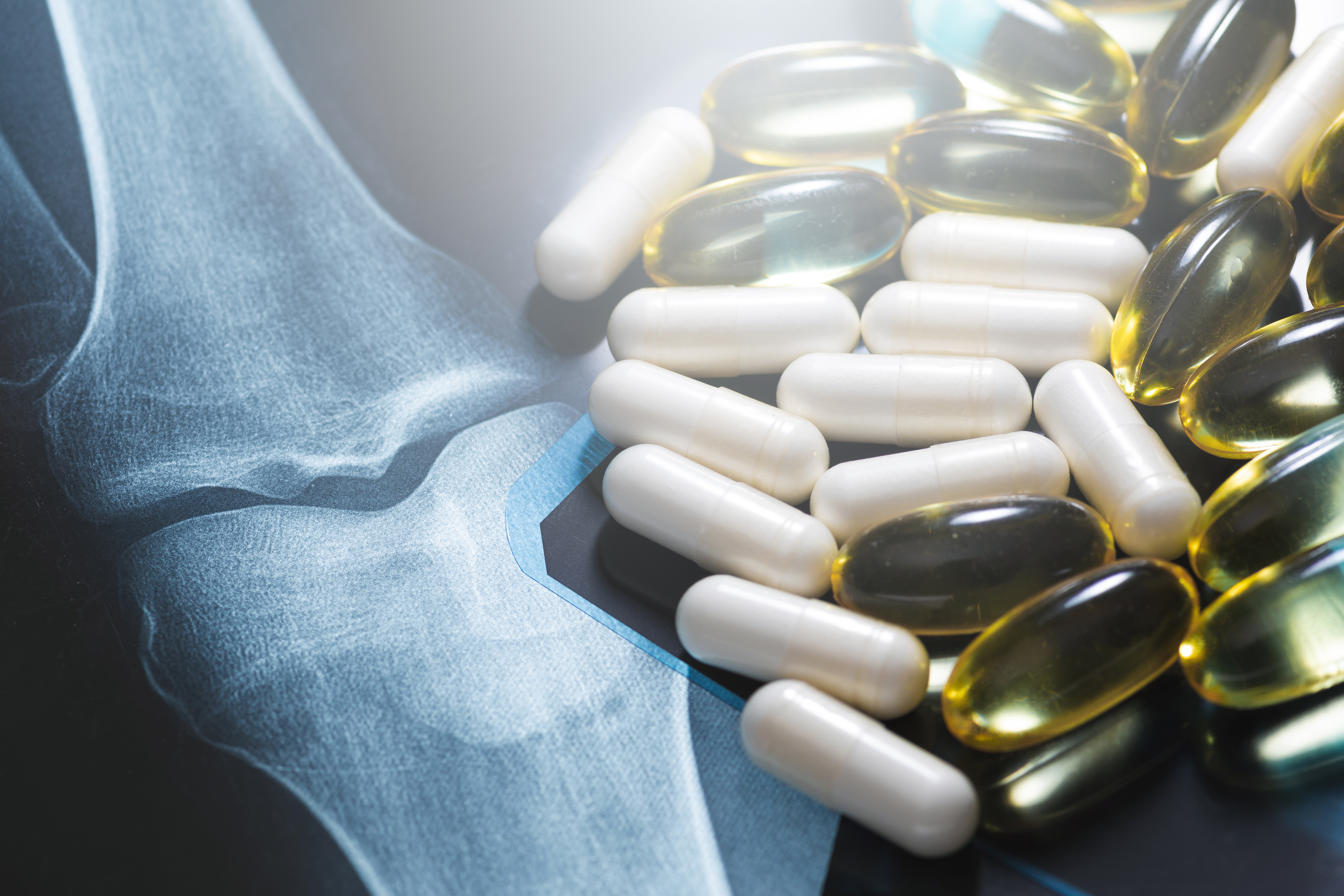 The Truth About Supplements for Knee Pain Knee Pain and Joint Health The Truth About Supplements for Knee Pain Knee Pain and Joint Health