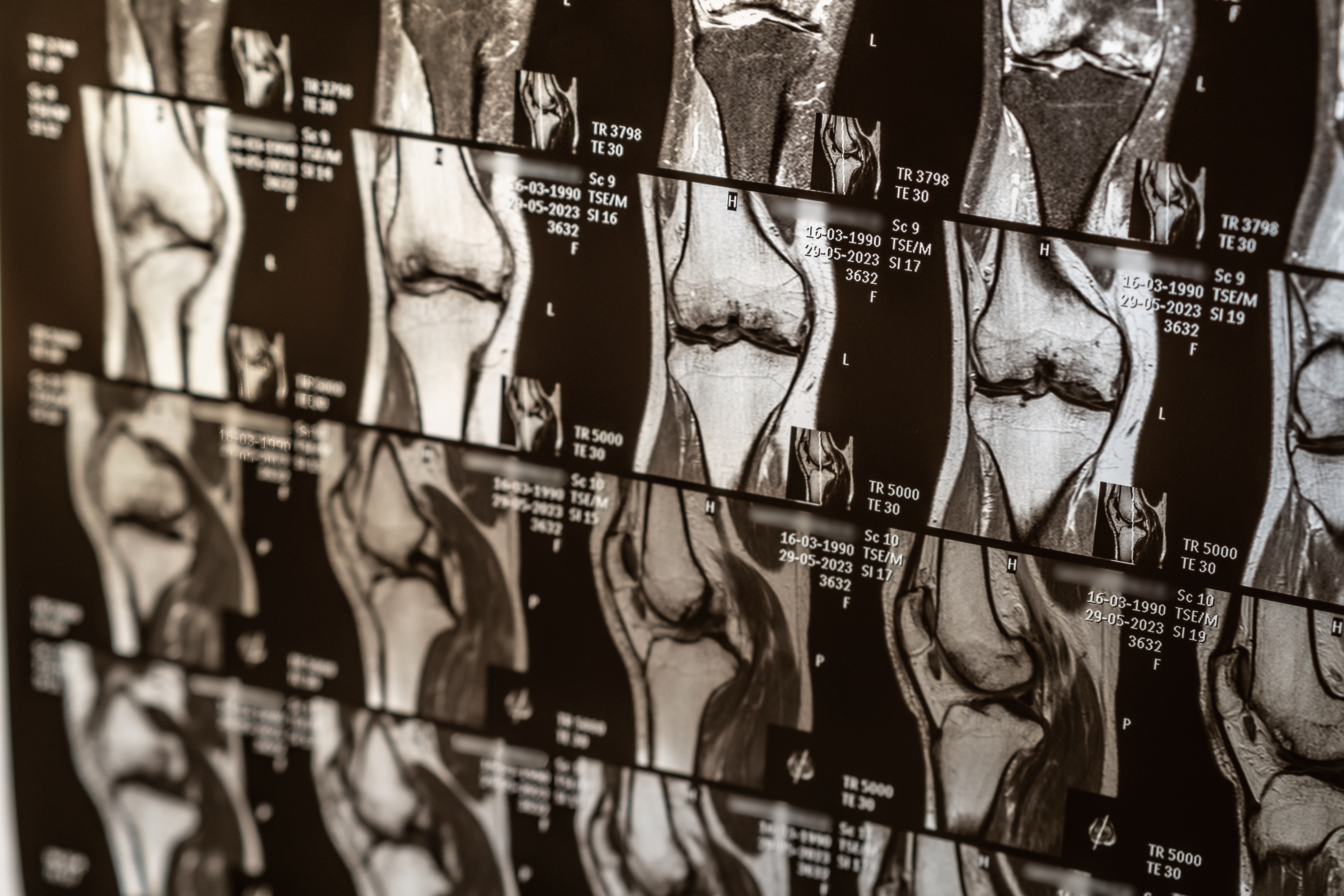 Why Your Knee Pain Isn’t Healing The 3 Things I Look At Before Any Treatment