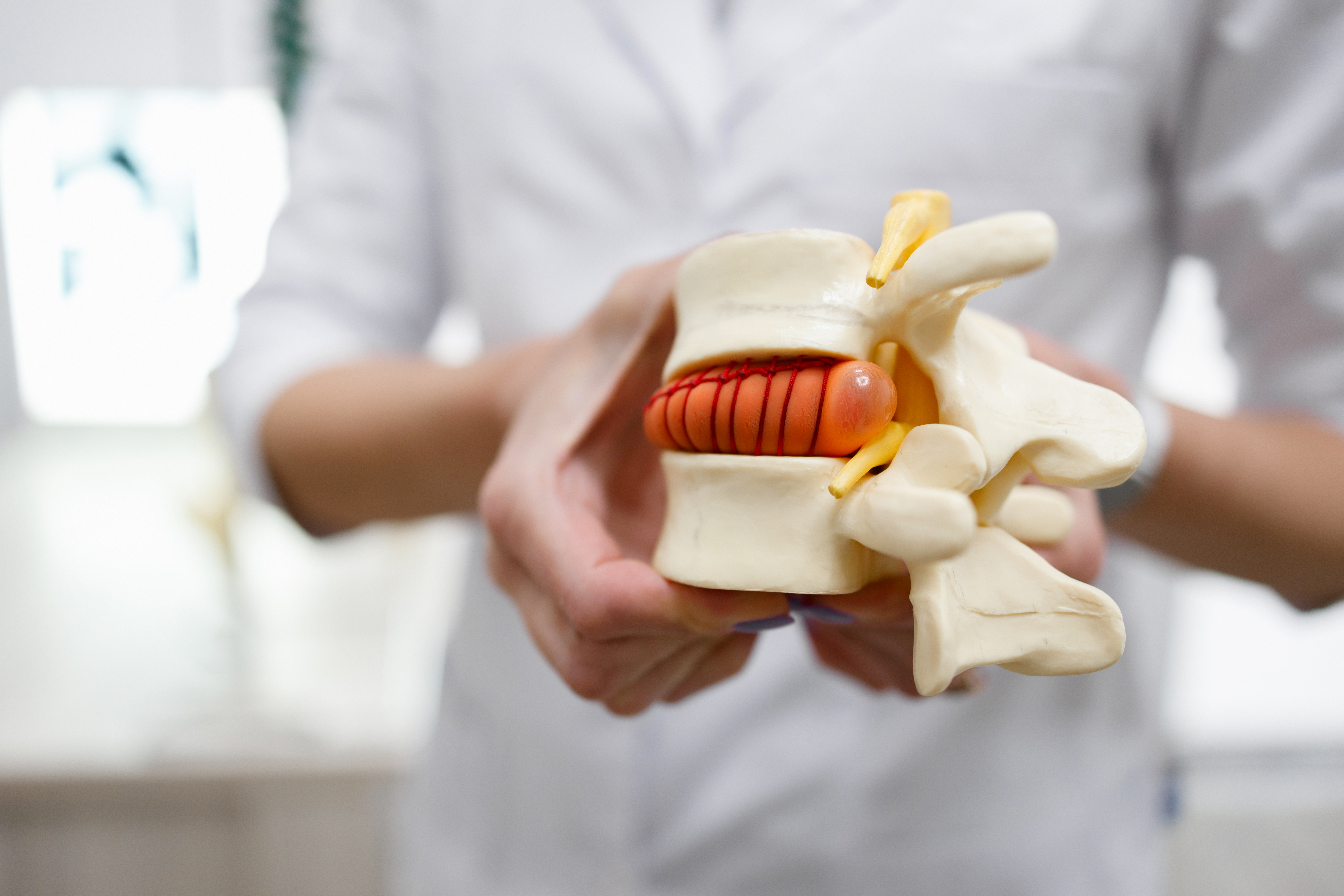 Why Treating One Disc Is Not the Same as Treating Your Spine Why Treating One Disc Is Not the Same as Treating Your Spine