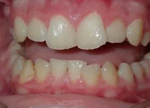 Before