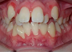 Before